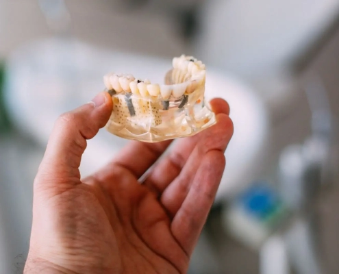 teeth made with dental AI