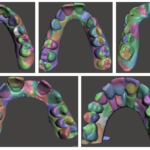 Dental Restoration using a Multi-Resolution Deep Learning Approach