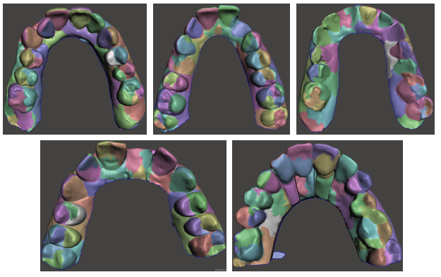 Dental Restoration using a Multi-Resolution Deep Learning Approach